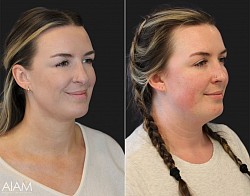 Before and after a course
